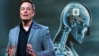 Elon Musk thành công xin cấp phép công nghệ cấy chip não ở người