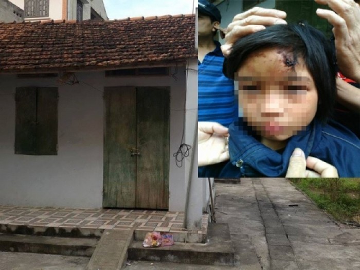 Rúng động Hưng Yên: Bé gái nghi bị hành hạ dã man trong chùa