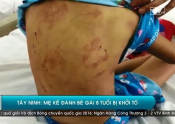 [VIDEO] Bé gái 8 tuổi bị mẹ kế đánh đập vì 1.000 đồng