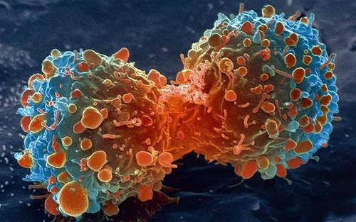 [VIDEO] Cận cảnh tế bào bạch cầu "săn diệt" tế bào ung thư