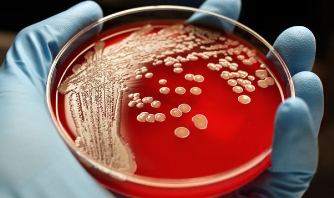 Phát hiện chấn động về 'siêu vi khuẩn', cơn ác mộng của loài người sắp đến?