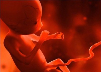 Phát hiện bào thai chết lưu trong bụng cậu bé 4 tuổi