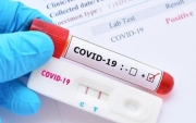 Bộ Công Thương: Người dân không nên mua kit test Covid-19 trên mạng