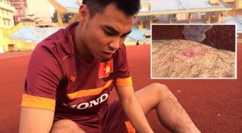 U23 Việt Nam gặp bão chấn thương, HLV Miura bổ sung nhân sự