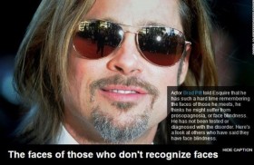 Brad Pitt mắc chứng bệnh kỳ lạ