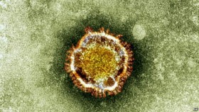 30 người chết vì virus mới giống bệnh SARS