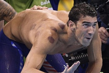 Vận động viên Mỹ ở Olympic Rio thi nhau đi... giác hơi