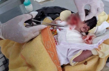 Cứu bé trai sơ sinh bị chôn sống ở Bình Thuận