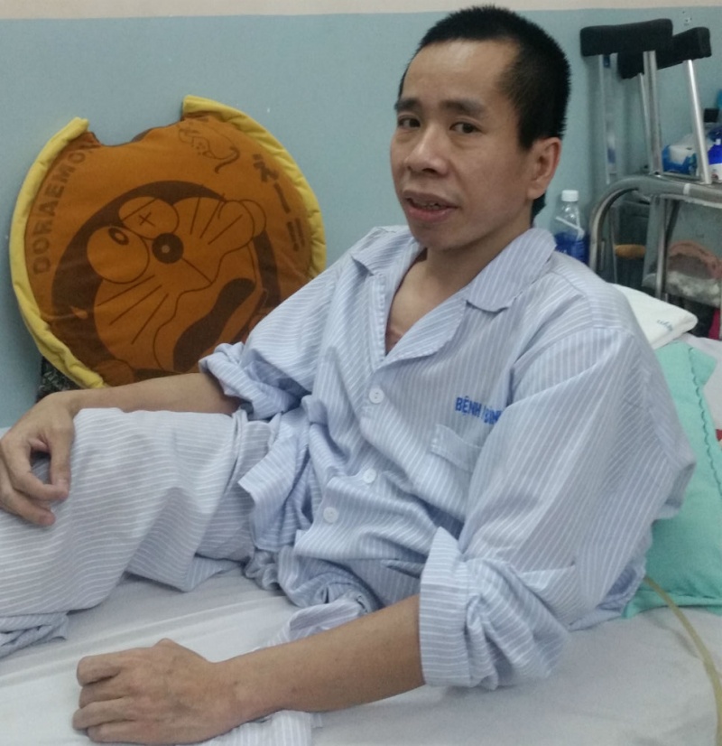 Phẫu thuật tạo hình niệu quản cho người em trong cặp song sinh Việt - Đức