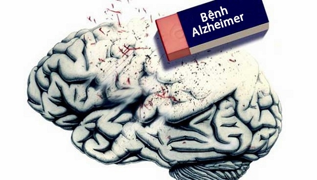 Phòng ngừa bệnh Alzheimer ở người lớn tuổi