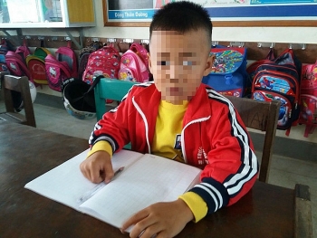 Quảng Bình: Sẽ xử lý nghiêm cô giáo tát học sinh lớp 1 chảy máu tai