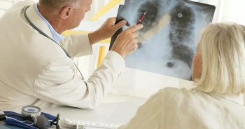 Làm sao để phục hồi phổi sau khi mắc Covid-19?