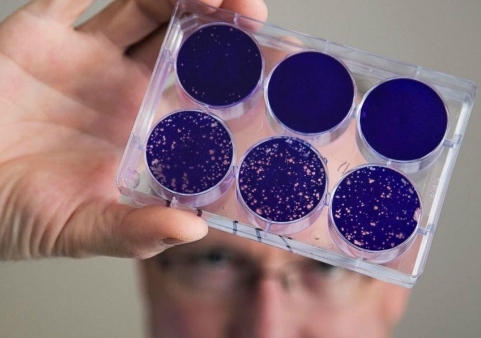 Virus bại liệt mang lại hy vọng mới chữa khỏi ung thư não
