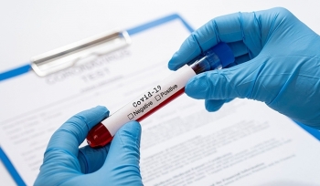 Tiêu chí phân loại nguy cơ người nhiễm SARS-CoV-2
