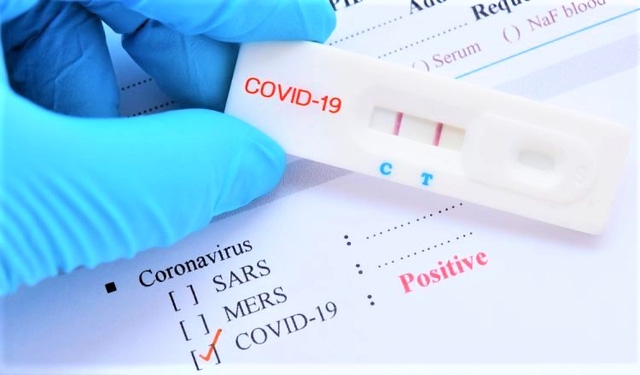 16 loại test nhanh kháng nguyên SARS-CoV-2 được Bộ Y tế cấp phép