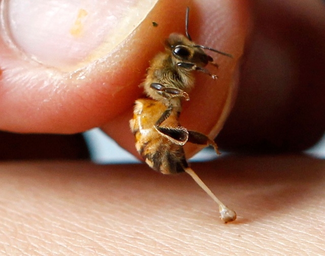 Phát hiện mới: Nọc độc ong có thể tiêu diệt tế bào ung thư
