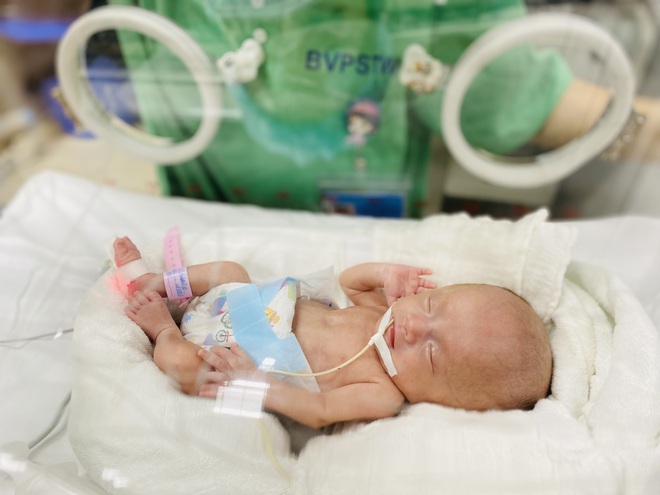 Kỳ tích cứu sống em bé nặng 400gram, nhỏ lọt thỏm trong lòng bàn tay - 2
