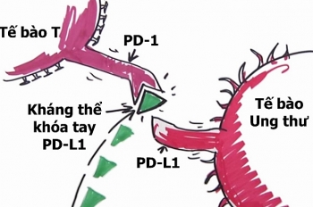 Bác sĩ Việt Nam: 'Liệu pháp miễn dịch là tiến bộ đột phá trong chữa ung thư'