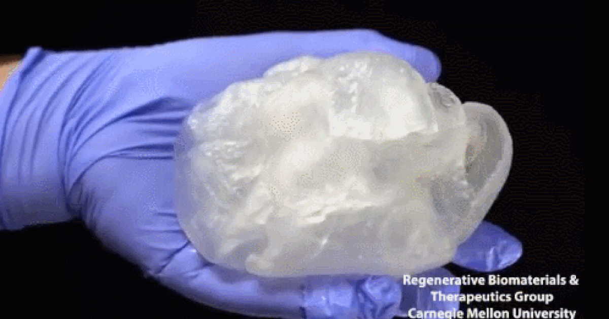 Các nhà khoa học đã in 3D trái tim người với kích thước như tim thật