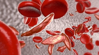 Điều trị các bệnh về máu nhờ liệu pháp chỉnh sửa gene