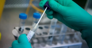 Hà Nội: Giá dịch vụ xét nghiệm RT-PCR tối đa gần 170 nghìn đồng