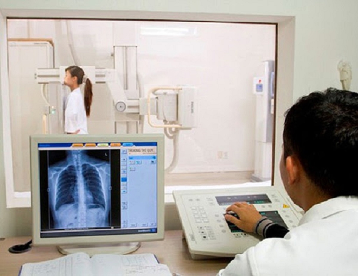Không nên lạm dụng chụp X-quang phổi hậu Covid-19