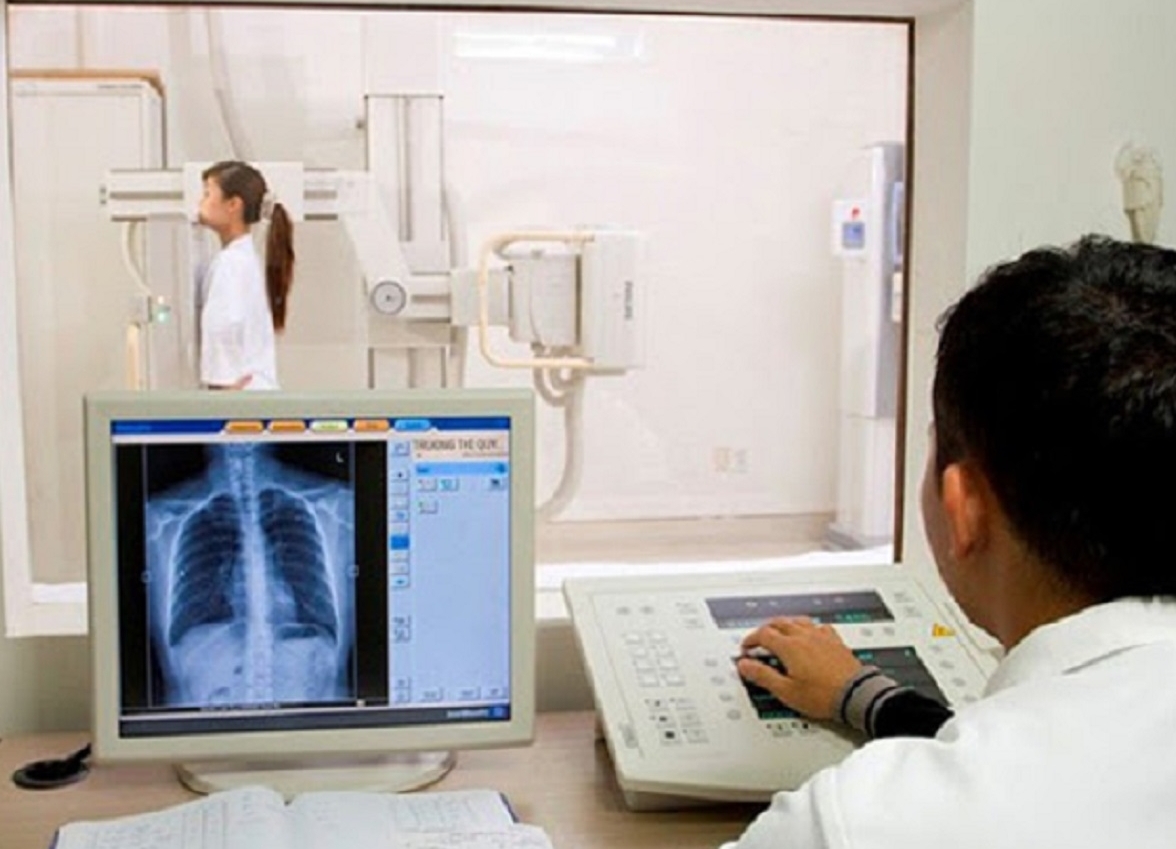 Không nên lạm dụng chụp X-quang phổi hậu Covid-19