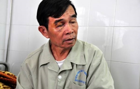 Chủ tịch hội nghề cá ở Lý Sơn bị hành hung