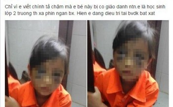 Lào Cai: Buộc thôi việc cô giáo đánh học sinh tím mắt