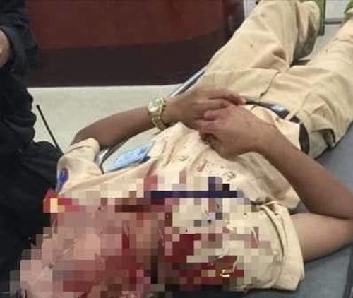 Hà Nội: Chiến sĩ CSGT bị thương khi đang làm nhiệm vụ