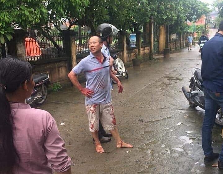 bat tam giam nghi pham vu an mang lam 5 nguoi thuong vong