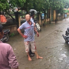 bong lai sau tham an