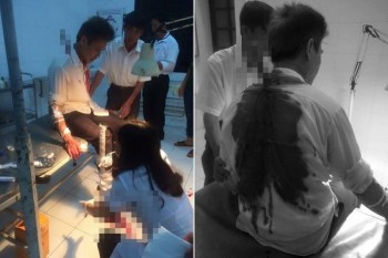 Thanh niên 15 tuổi cướp xe ôm ở Thái Bình