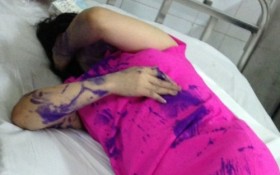 Hà Nội: một người phụ nữ bị hành hung và đổ mực vào miệng