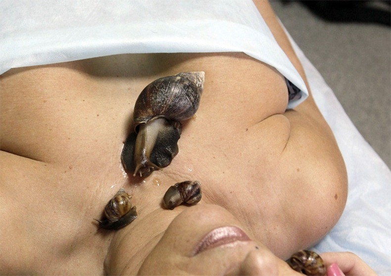 Massage bằng ốc sên: Mốt làm đẹp mới