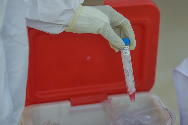 Xét nghiệm PCR lần 3 mới dương tính SARS-CoV-2: Chuyên gia nói gì?