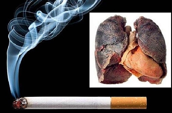 Tỷ lệ hút thuốc lá giảm đáng kể