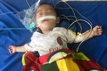 Chữa tiêu chảy bằng thuốc phiện, bé trai 1 tuổi ngừng thở do ngộ độc