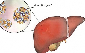 Viêm gan virus đang là một đại dịch